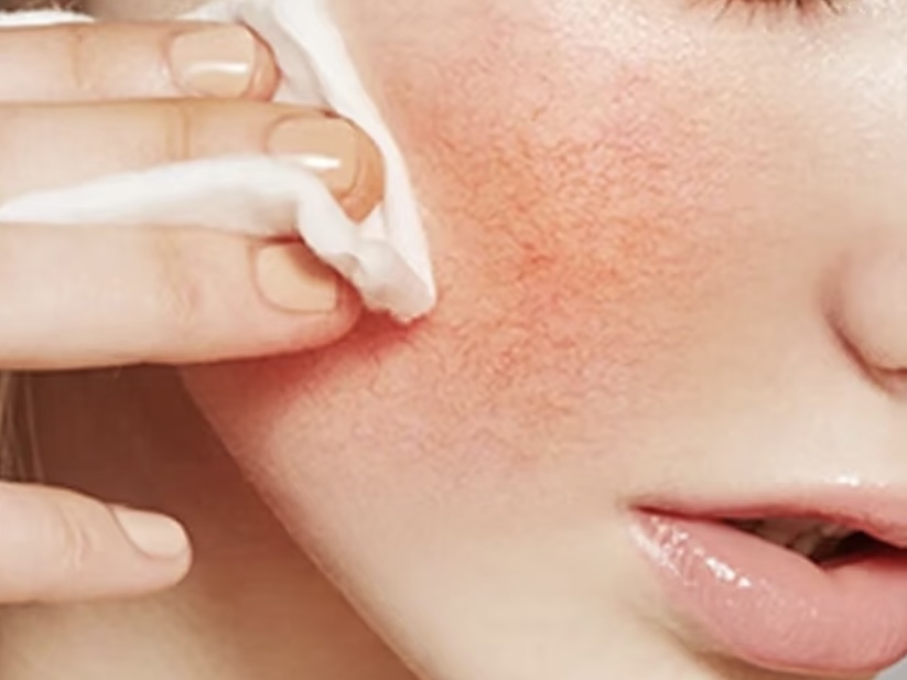 老过敏可能是缺乏维生素，来了解下是怎么回事