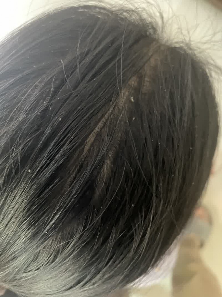 头皮屑多又出油？这5款洗发水值得试试